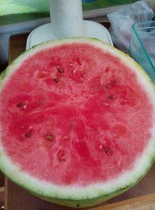 女子吃瓜进医院,警惕夏日饮食陷阱